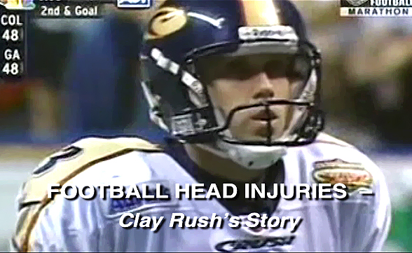 Football Head Injuries - Clay Rush's Story